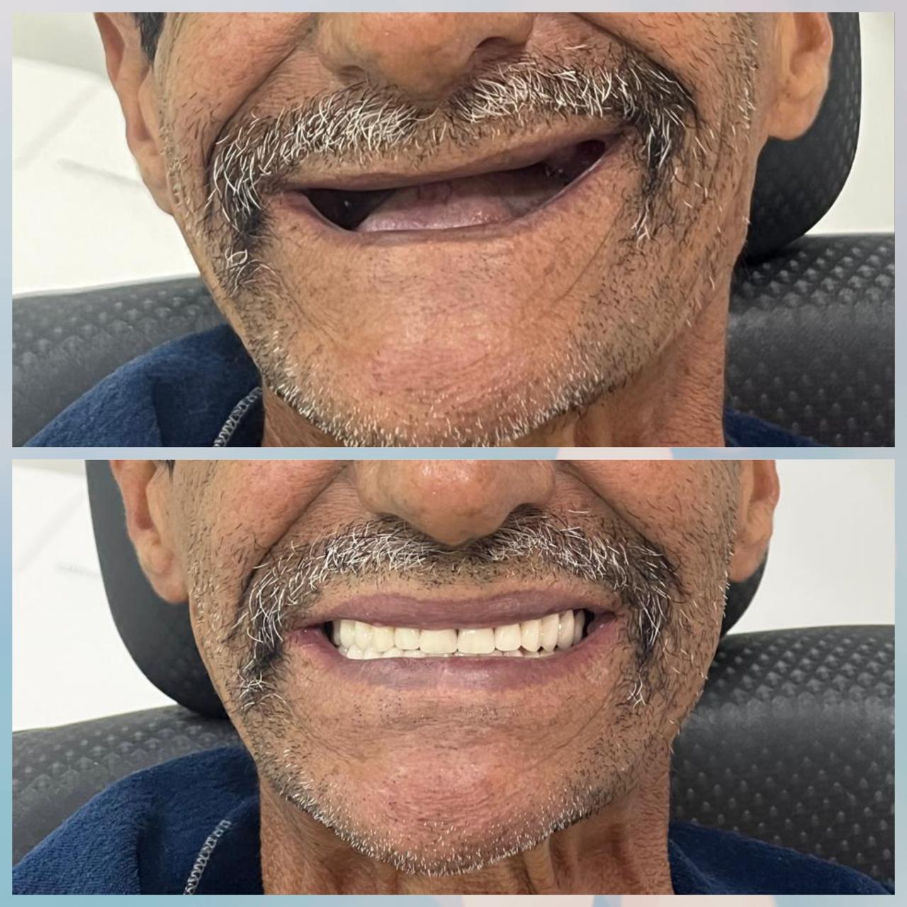 Resultado sorriso 2